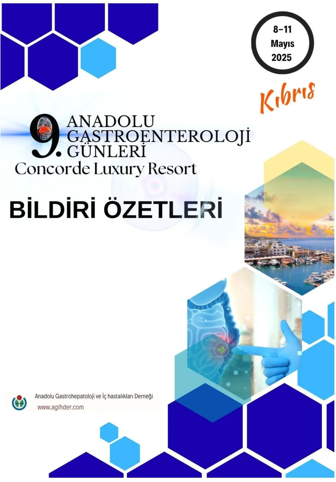 9.Anadolu Gastroenteroloji Günleri Kıbrıs Bildiri Özetleri